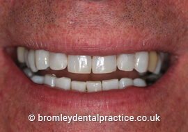 Cosmetic Dentist in Bromley
